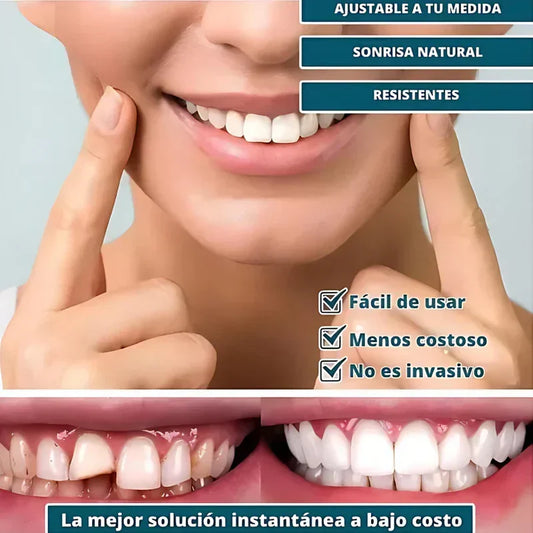 SmilePro 🦷 - Carillas Dentales Ajustables de Resina + ESTUCHE DE REGALO - ¡Últimas unidades!