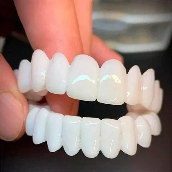 SmilePro 🦷 - Carillas Dentales Ajustables de Resina + ESTUCHE DE REGALO - ¡Últimas unidades!